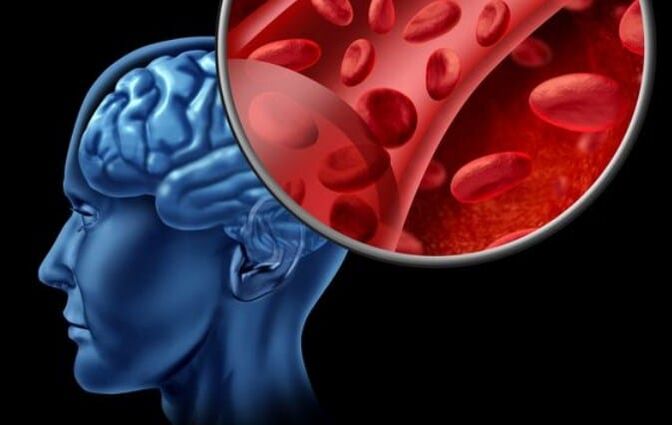 Oxygen starvation of the brain