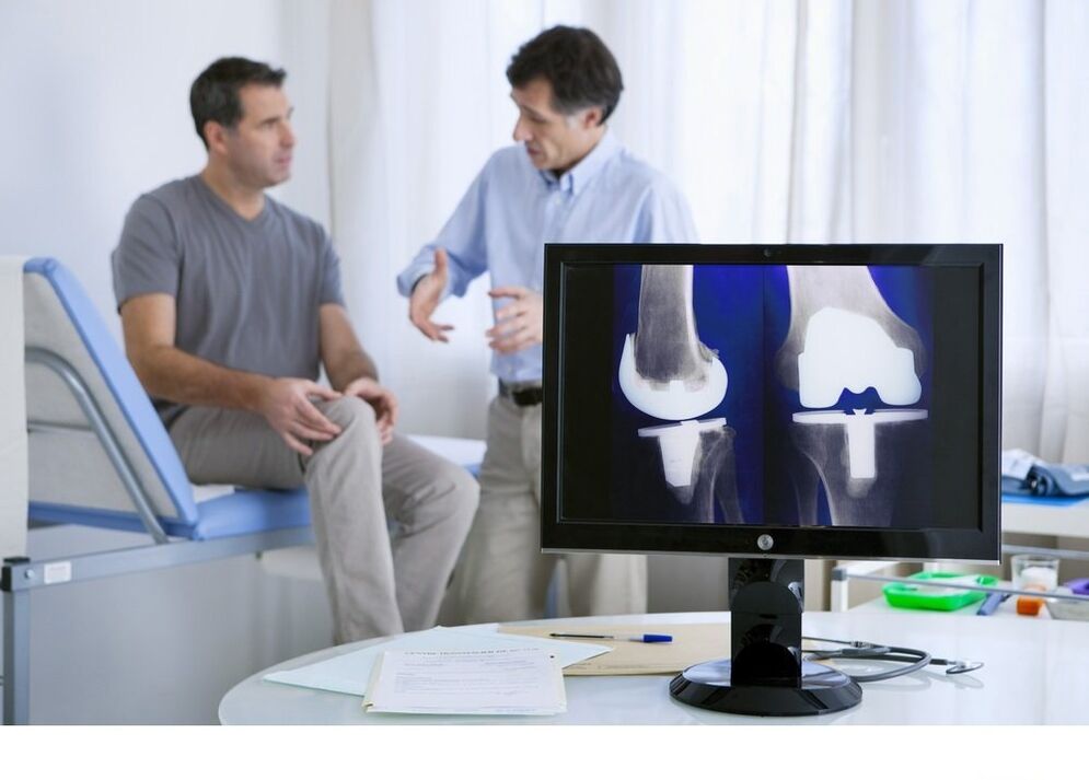 arthrosis of the knee joint in the x -ray picture